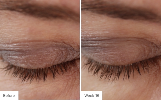 Close-up image of eyelashes showing fuller and longer lashes after 16 weeks of Lash Lush use